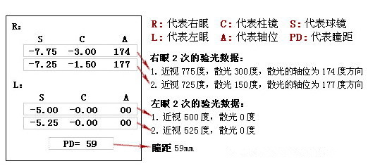 眼科醫(yī)生教你如何一分鐘看懂驗光單！