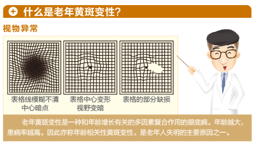 【看圖解】老年黃斑變性是怎么回事